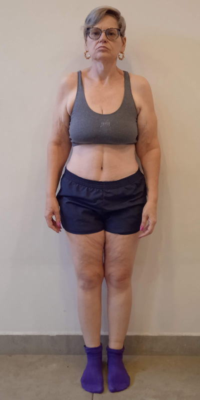 Isabel Soares - Antes e Depois
