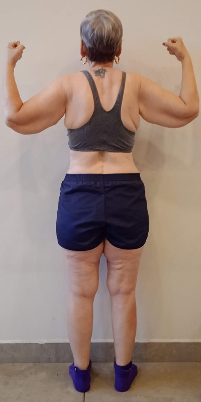 Isabel Soares - Antes e Depois