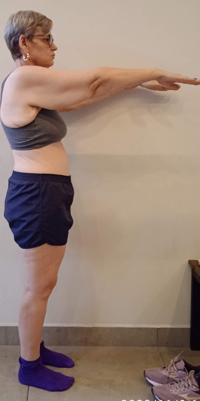 Isabel Soares - Antes e Depois
